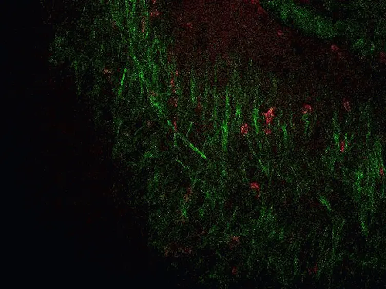 Visualizing Angiogenesis by Multiphoton Microscopy<em> In Vivo</em> in Genetically Modified 3D-PLGA/nHAp Scaffold for Calvarial Critical Bone Defect Repair