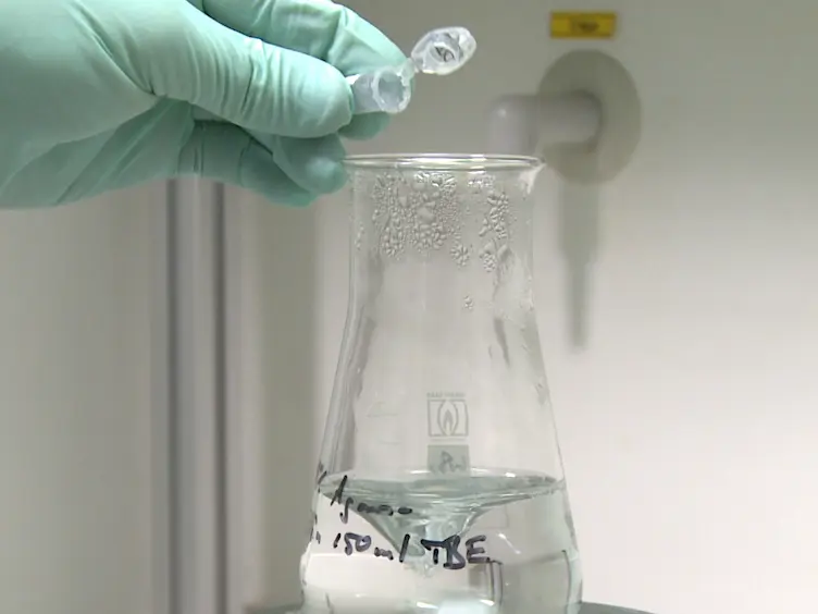 Assessment of DNA Contamination in RNA Samples Based on Ribosomal DNA