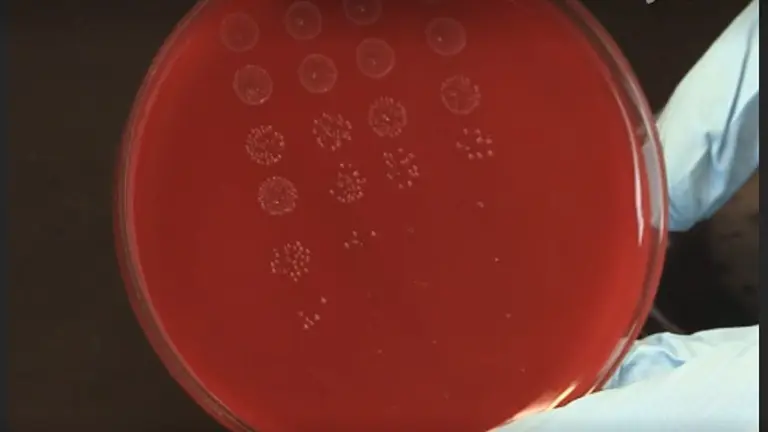 Expression, Purification, and Antimicrobial Activity of S100A12