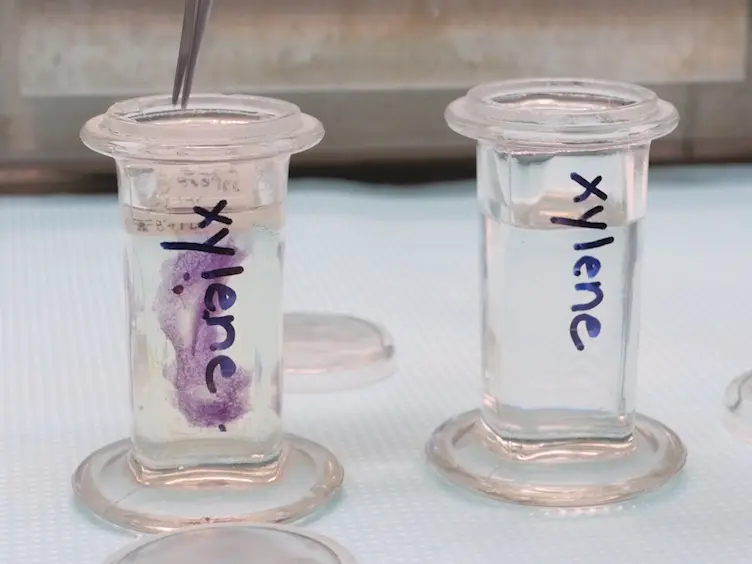 Sectioning Mammary Gland Whole Mounts for Lesion Identification