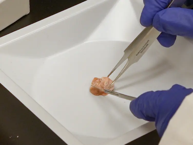 Enrichment of Detergent-insoluble Protein Aggregates from Human Postmortem Brain