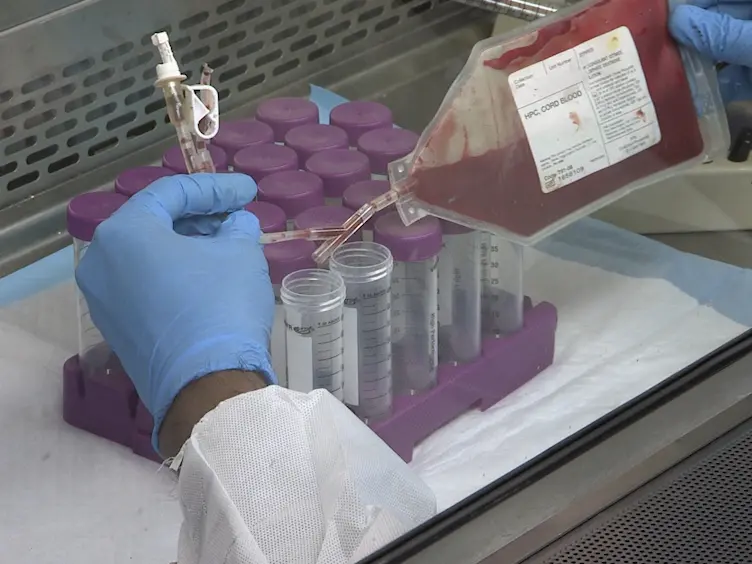 Isolation of Endothelial Progenitor Cells from Human Umbilical Cord Blood