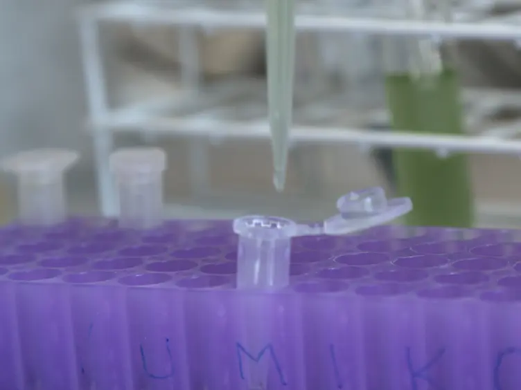 Determination of the Glycogen Content in Cyanobacteria
