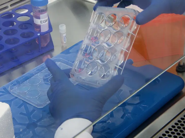 The Aortic Ring Co-culture Assay: A Convenient Tool to Assess the Angiogenic Potential of Mesenchymal Stromal Cells <em>In Vitro</em>