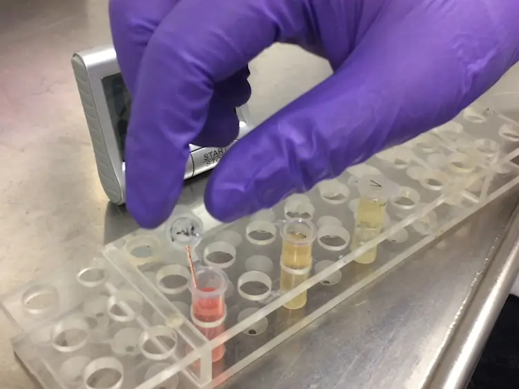 Cryopreservation of Zebrafish Spermatogonia by Whole Testes Needle Immersed Ultra-Rapid Cooling