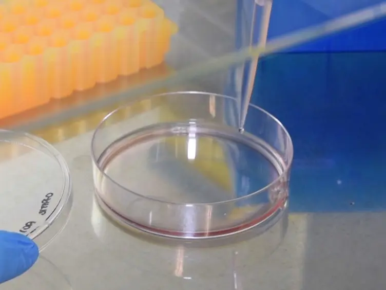 Live-imaging of Breast Epithelial Cell Migration After the Transient Depletion of TIP60