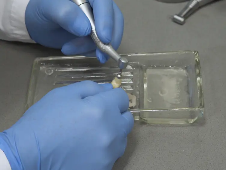 Mimicking and Measuring Occlusal Erosive Tooth Wear with the "Rub&amp;Roll" and Non-contact Profilometry