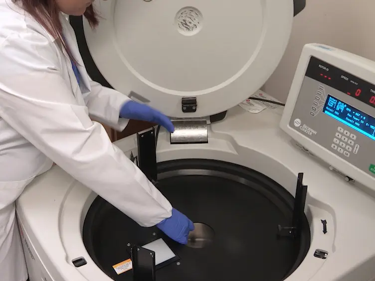 Preparation of Primary Acute Lymphoblastic Leukemia Cells in Different Cell Cycle Phases by Centrifugal Elutriation