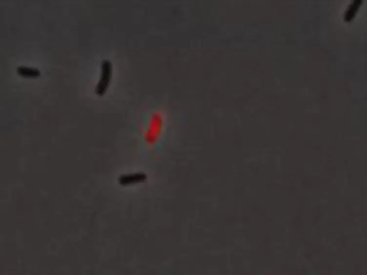 Live Cell Fluorescence Microscopy to Observe Essential Processes During Microbial Cell Growth