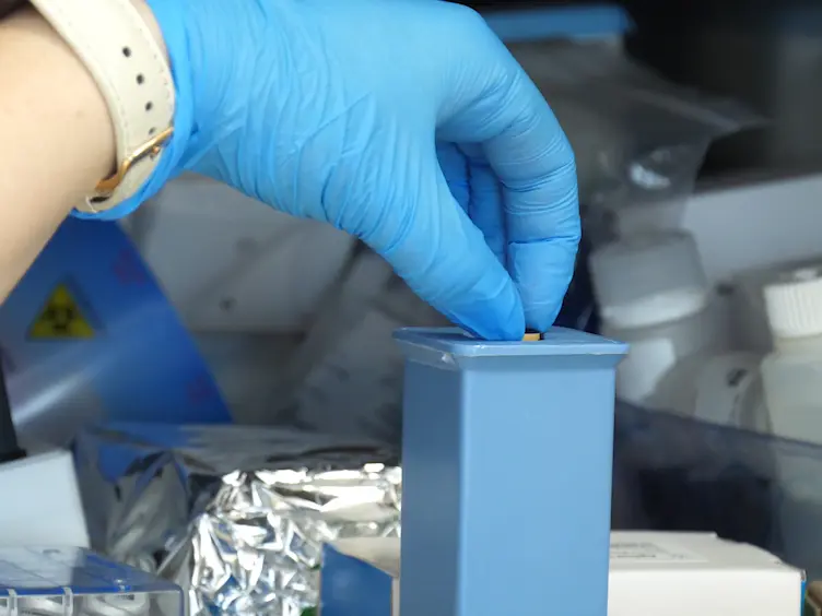 Serum and Plasma Copy Number Detection Using Real-time PCR