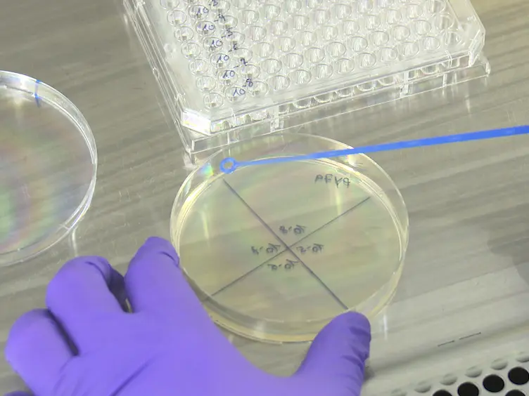Investigating the Detrimental Effects of Low Pressure Plasma Sterilization on the Survival of <em>Bacillus subtilis</em> Spores Using Live Cell Microscopy