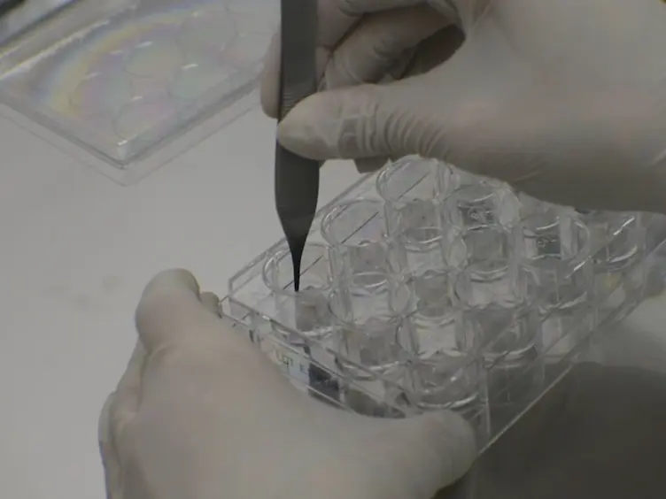 A Novel <em>In Vitro</em> Wound Healing Assay to Evaluate Cell Migration