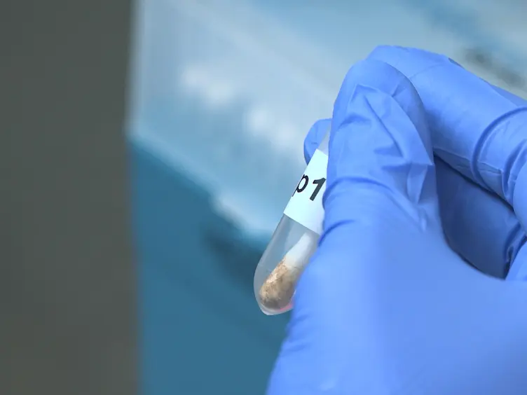 Guided Protocol for Fecal Microbial Characterization by 16S rRNA-Amplicon Sequencing