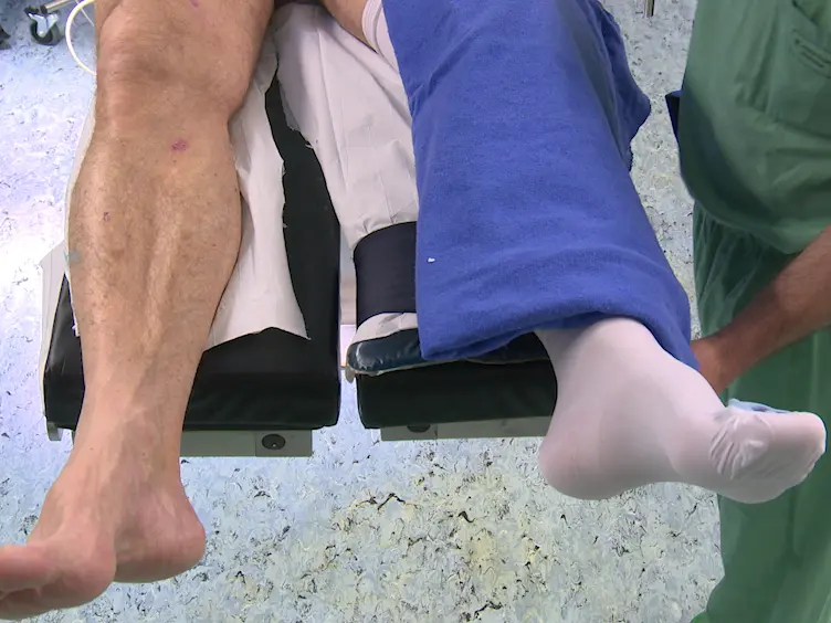 Individualized Stem-positioning in Calcar-guided Short-stem Total Hip Arthroplasty