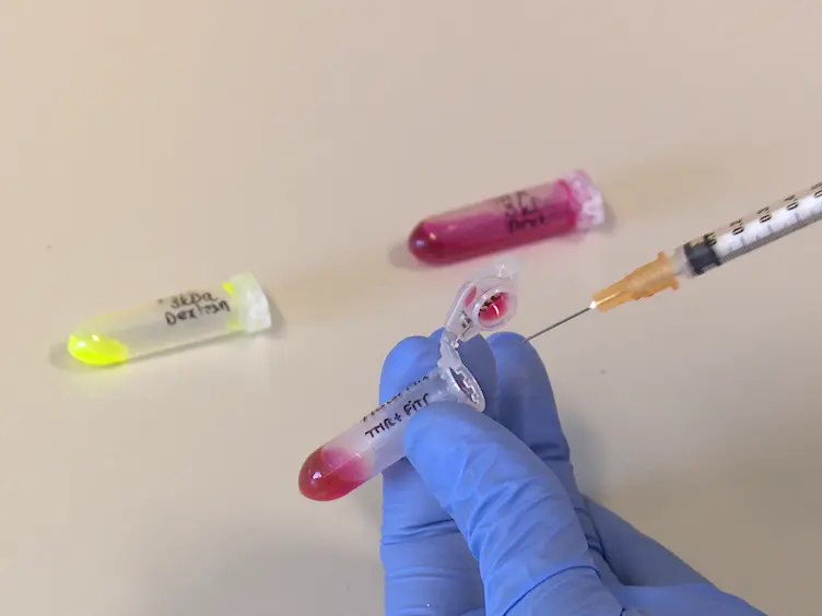 An <em>In Vivo</em> Blood-brain Barrier Permeability Assay in Mice Using Fluorescently Labeled Tracers