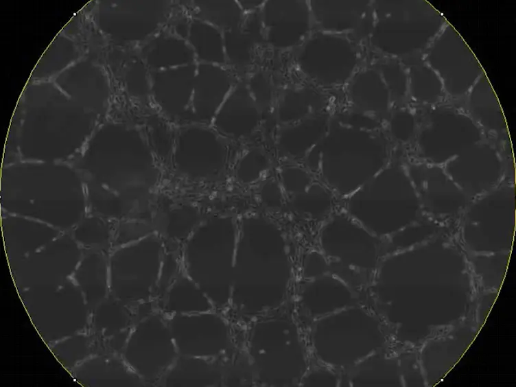 Kinetic Analysis of Vasculogenesis Quantifies Dynamics of Vasculogenesis and Angiogenesis <em>In Vitro</em>