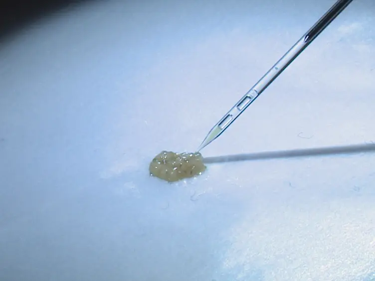 Extraction of Hemocytes from <em>Drosophila melanogaster</em> Larvae for Microbial Infection and Analysis