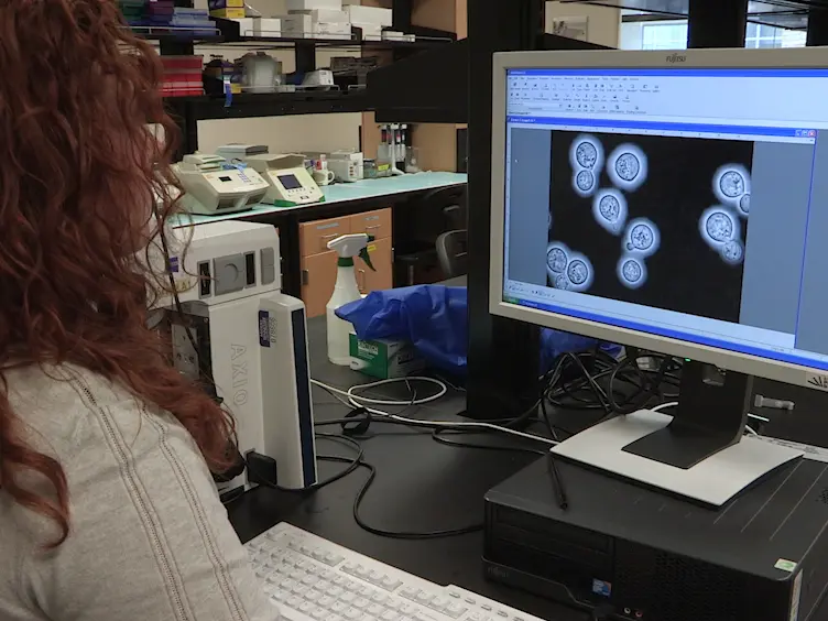 Size Matters: Measurement of Capsule Diameter in <em>Cryptococcus neoformans</em>