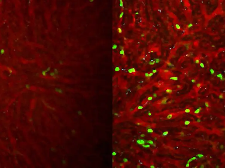 Two-photon Intravital Imaging of Leukocytes During the Immune Response in Lipopolysaccharide-treated Mouse Liver