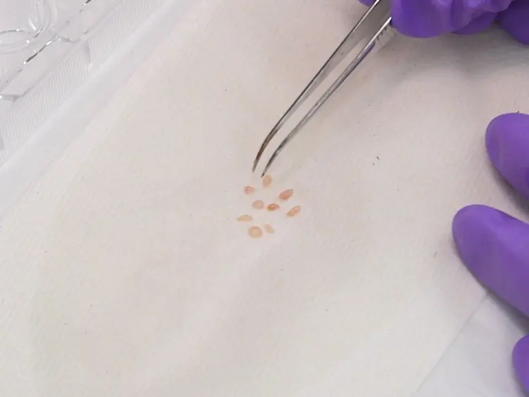 Isolating Lymphocytes from the Mouse Small Intestinal Immune System