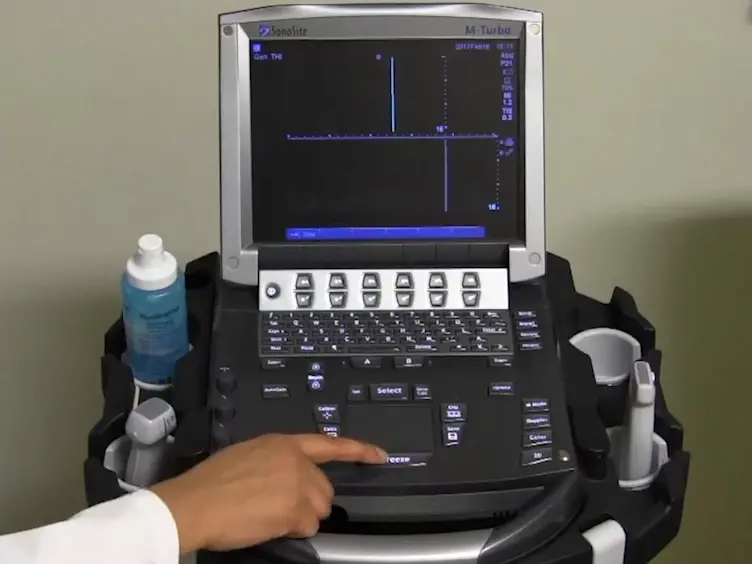 Bedside Ultrasound for Guiding Fluid Removal in Patients with Pulmonary Edema: The Reverse-FALLS Protocol