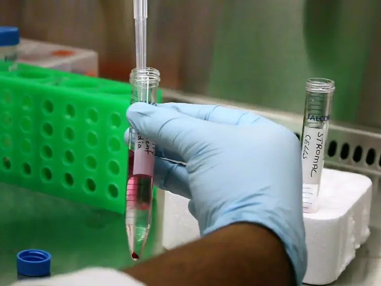 Isolation of Human Endometrial Stromal Cells for <em>In Vitro</em> Decidualization