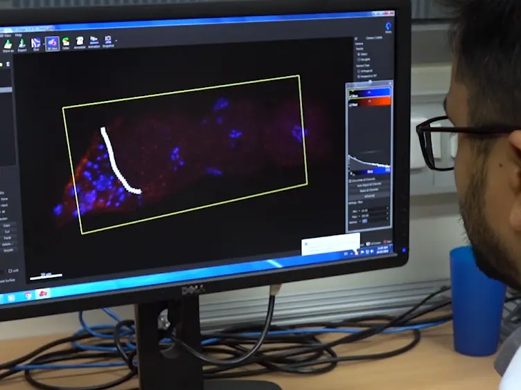 Computational Analysis of the <em>Caenorhabditis elegans</em> Germline to Study the Distribution of Nuclei, Proteins, and the Cytoskeleton