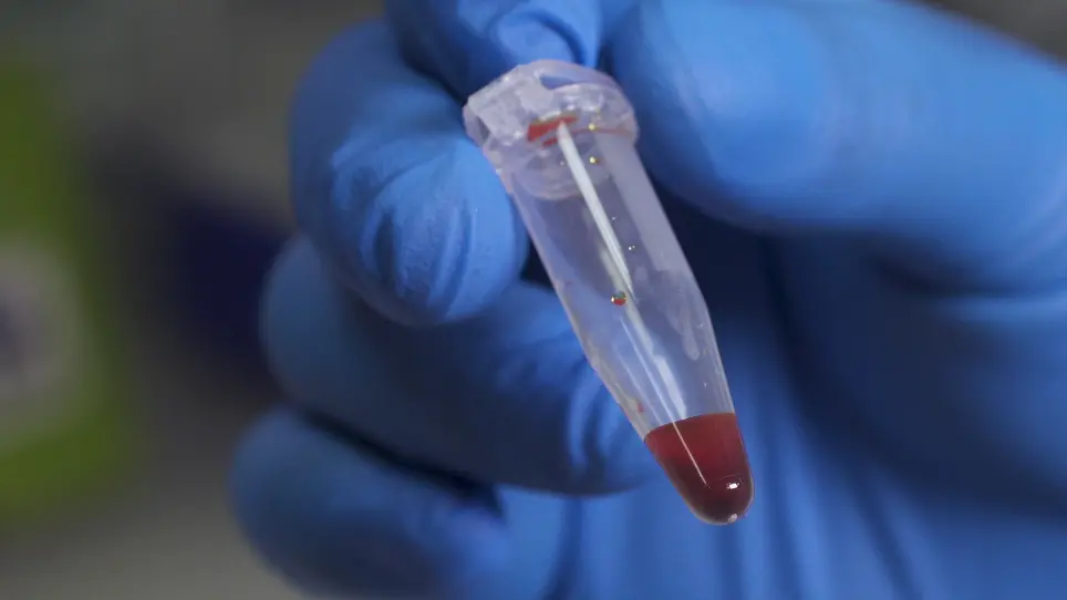 A Silver Nanoparticle Method for Ameliorating Biliary Atresia Syndrome in Mice