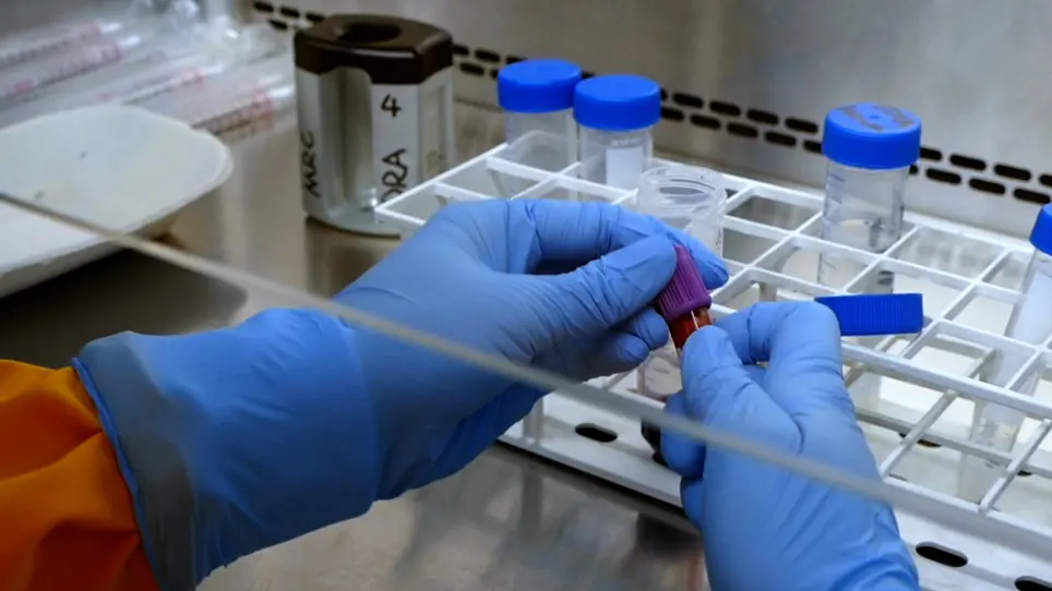 Human Peripheral Blood Neutrophil Isolation for Interrogating the Parkinson's Associated LRRK2 Kinase Pathway by Assessing Rab10 Phosphorylation