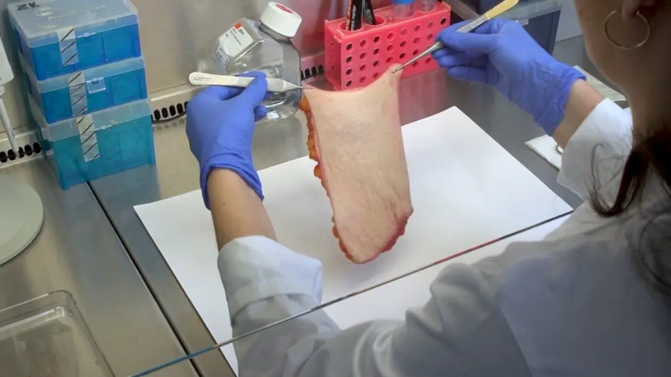 Isolation of Papillary and Reticular Fibroblasts from Human Skin by Fluorescence-activated Cell Sorting
