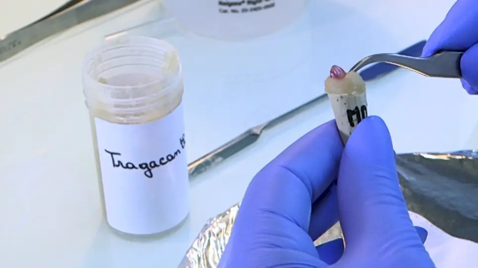 Immunolabelling Myofiber Degeneration in Muscle Biopsies