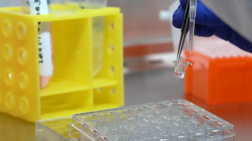 In Vitro Model of Coronary Angiogenesis