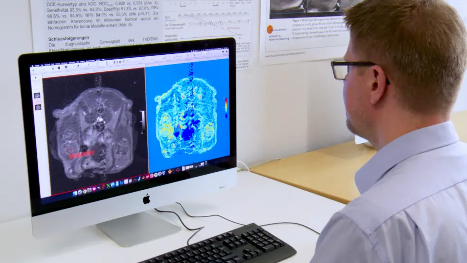 Machine Learning Algorithms for Early Detection of Bone Metastases in an Experimental Rat Model
