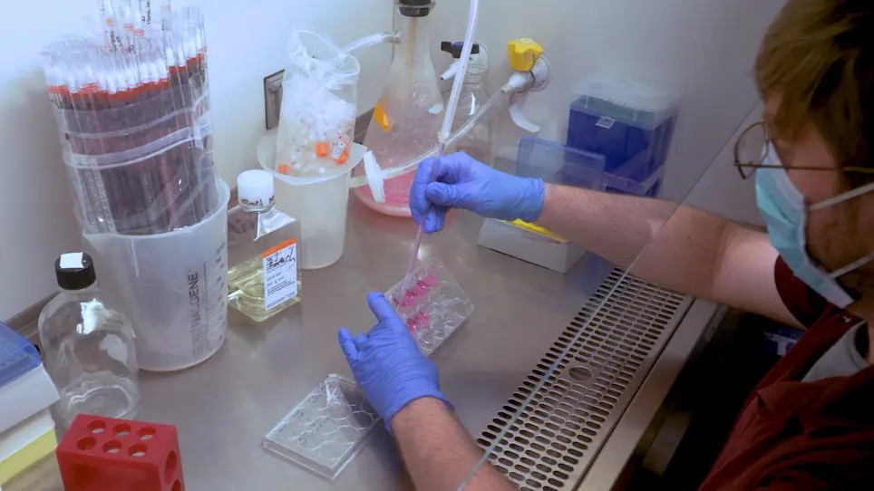 Assays for Validating Histone Acetyltransferase Inhibitors