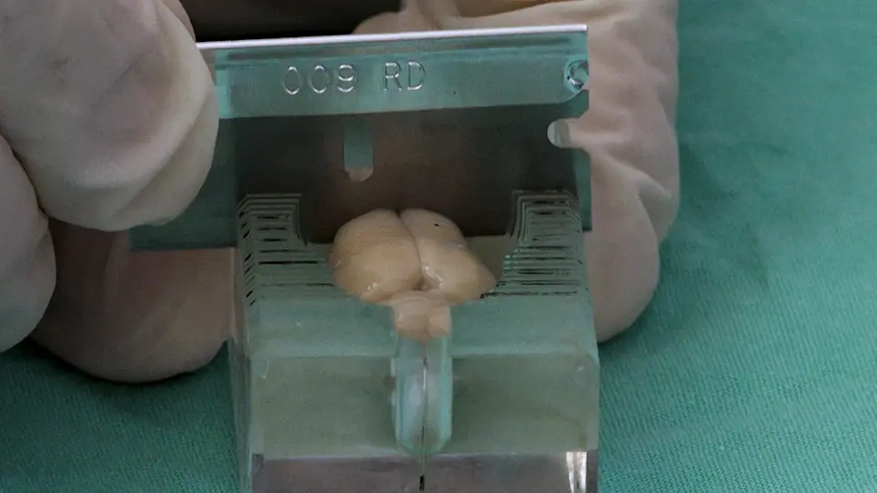 Measuring Post-Stroke Cerebral Edema, Infarct Zone and Blood-Brain Barrier Breakdown in a Single Set of Rodent Brain Samples