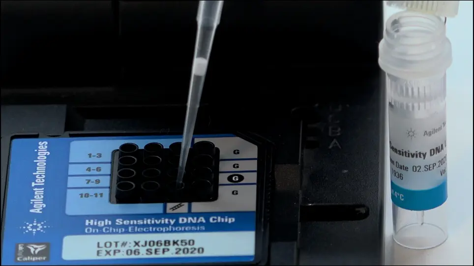 Detection of Cell-Free DNA in Blood Plasma Samples of Cancer Patients