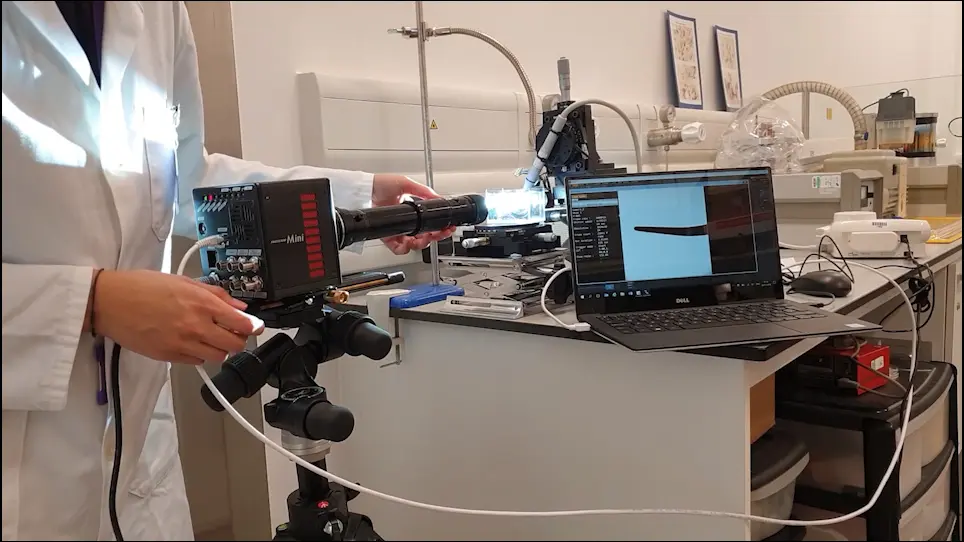 Imaging and Quantification of the Area of Fast-Moving Microbubbles Using a High-Speed Camera and Image Analysis