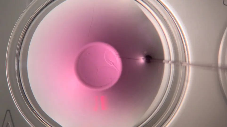 Minimum Volume Vitrification of Immature Feline Oocytes