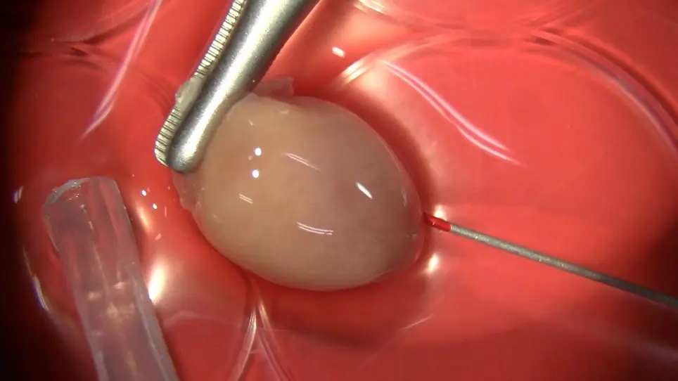 An Antegrade Perfusion Method for Cardiomyocyte Isolation from Mice
