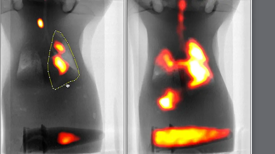 In vivo Evaluation of Mucociliary Clearance in Mice