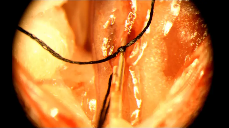 Direct Drug Delivery to Kidney via the Renal Artery