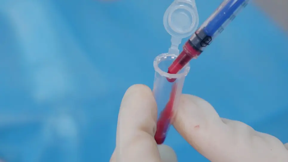 Massive Pontine Hemorrhage by Dual Injection of Autologous Blood
