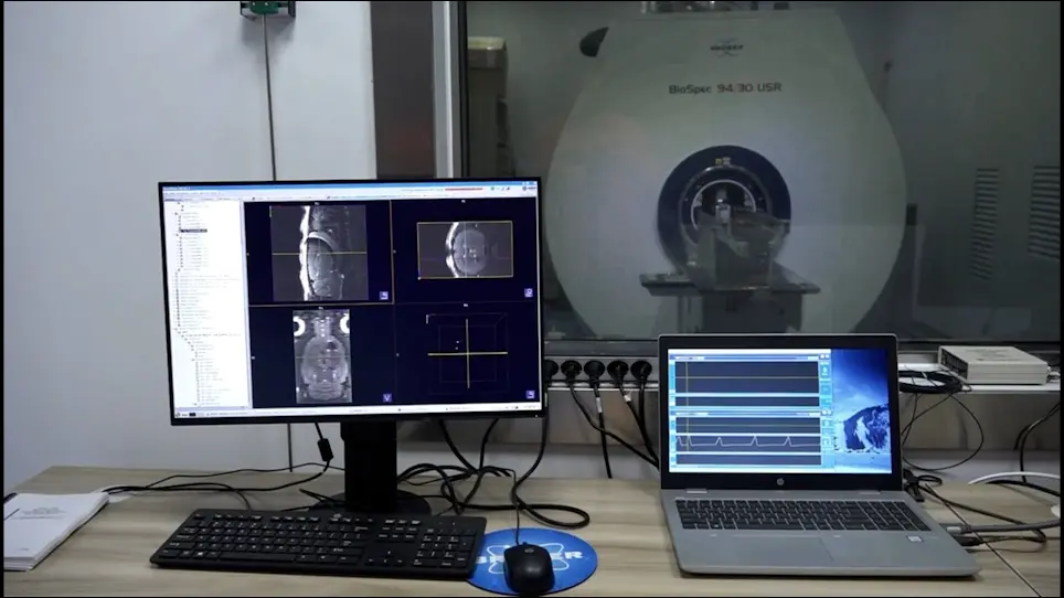 Establishment of a Rat Model of Superior Sagittal-Sinus Occlusion via a Thread-Embolism Method