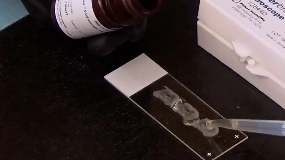 A Rat Model of EcoHIV Brain Infection