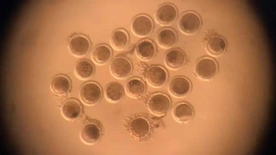 Vitrification of In Vitro Matured Oocytes Collected from Adult and Prepubertal Ovaries in Sheep