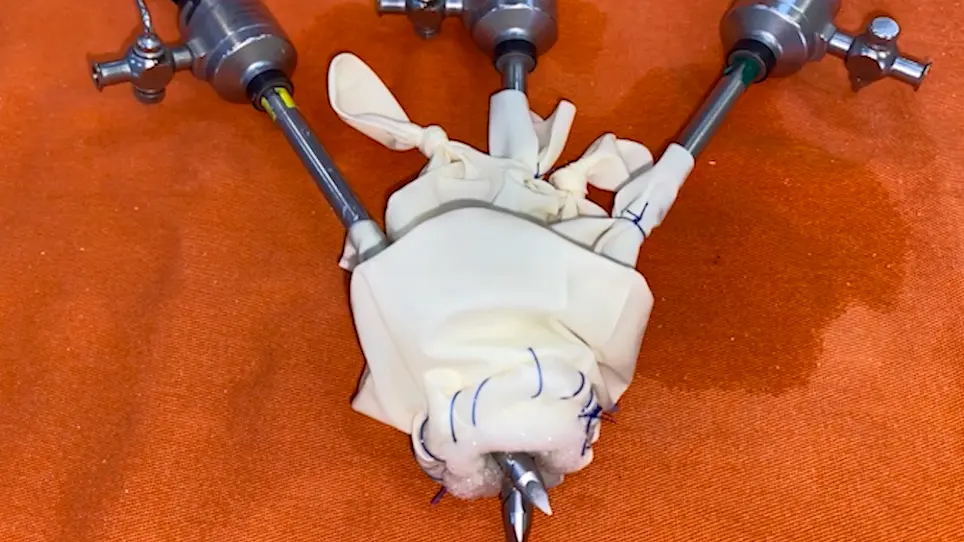 Low-Cost Single-Port (LoCoSP) Device for a Transcervical Approach in Minimally Invasive Transhiatal Esophagectomy