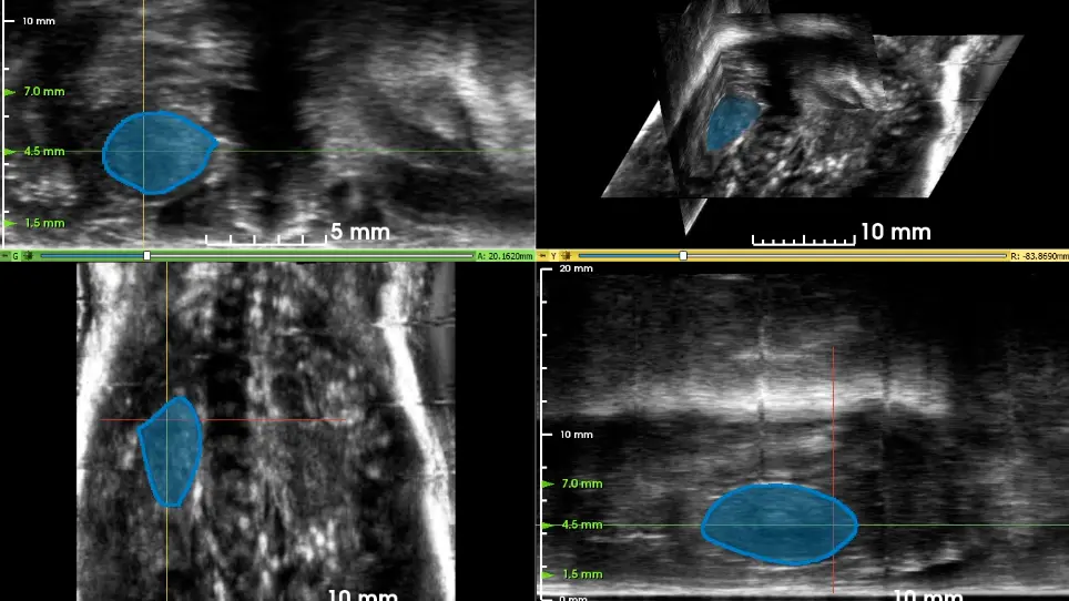 Use of 3D Robotic Ultrasound for <em>In Vivo</em> Analysis of Mouse Kidneys