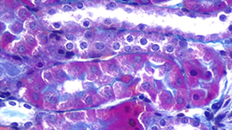 An Effective Mouse Model of Unilateral Renal Ischemia-Reperfusion Injury