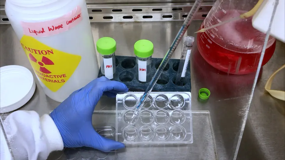 Evaluation of Amino Acid Consumption in Cultured Bone Cells and Isolated Bone Shafts