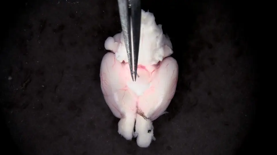 Isolation and Functional Analysis of Arteriolar Endothelium of Mouse Brain Parenchyma